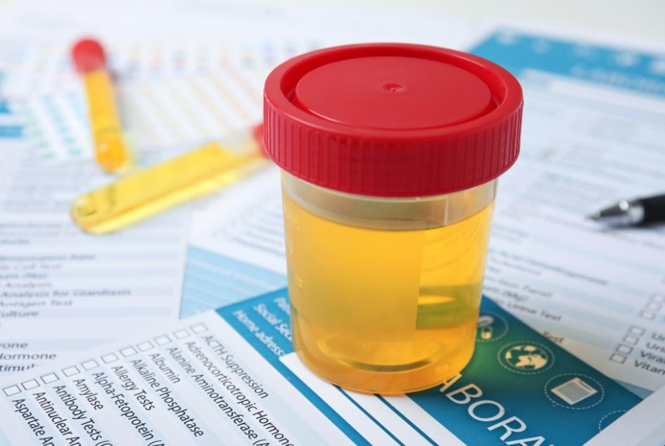what happens if you fail a drug test on probation